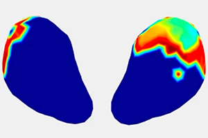 Imaging Tech Produces Real-time 3D Maps of Uterine Contractions During Labor